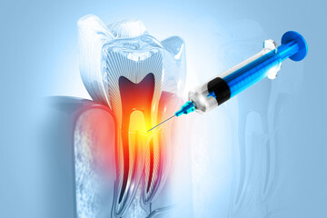 Dental injection. local Dental anesthesia. 3d illustration