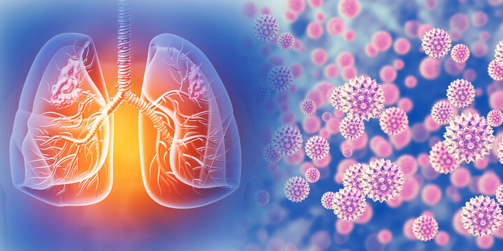 Chronic obstructive pulmonary disease, respiratory diseases, virus infection. 3d illustration