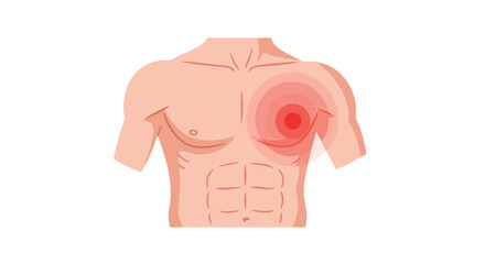 Vector Medical Illustration of Human Chest with Highlighted Breast Pain in Modern Minimalist Style