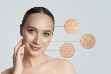 Skin care. Creative collage with a portrait of a beautiful young woman with enlarged areas of...