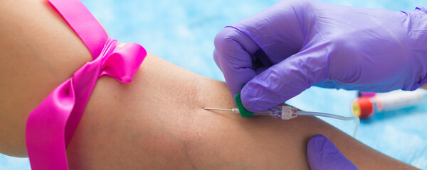 Nurse drawing blood with butterfly needle during venipuncture