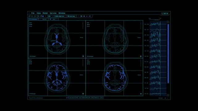 A medical monitor displays images of brain scans and an electroencephalogram reading. The images show different angles of the brain, revealing its internal structure and activity