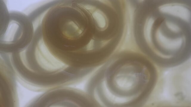 The nematodes (Nematoda), roundworms or eelworms constitute the phylum Nematoda. Species in the phylum inhabit a broad range of environments. Found in freshwater crabs.