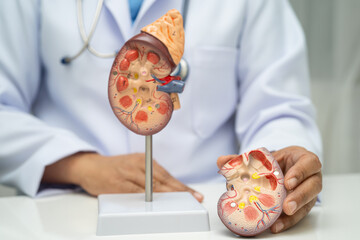 Chronic kidney disease, doctor with model for treatment urinary system, urology, Estimated...