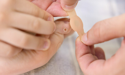 Child with callus on foot and toe lies on blanket. Parent applies adhesive bandage as treatment. Close-up of blister or corn care. Foot care and family support at home, natural light.