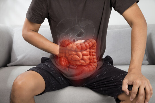 Illustration of Irritable Bowel Syndrome (IBS), colon inflammation, abdominal pain, and gastrointestinal disorders. Common symptoms include cramps, bloating, and irregular bowel movements.