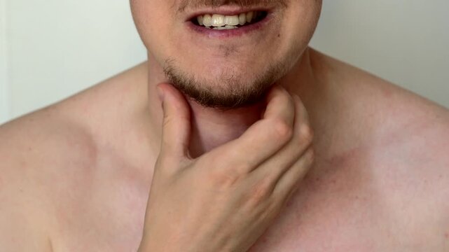Itching on the neck due to dry skin.
Eczema and ss code problems in a Caucasian guy with a beard.
Naked guy scratching his neck with his hands in the room.
Concept of medicine and cosmetology