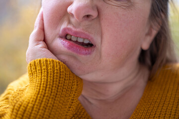 Suffering woman in pain touching jaw, toothache, painful tooth, gum swelling, worried expression,...