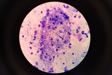 Microscopic view of fungal spores observed in a urogenital smear. The spores appear oval or round and may be seen individually or in clusters. 