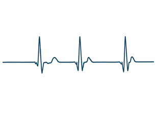 ECG Heartbeat Tracing on Graph Paper with Regular Sinus Rhythm, isolated on a transparent background.