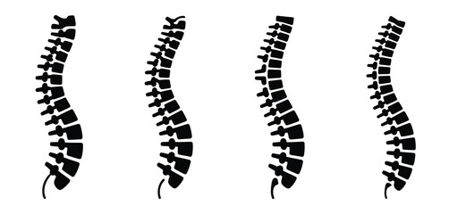 Four silhouettes of human spines showing different curvatures