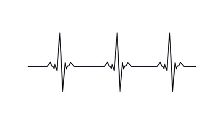 Simple electrocardiogram waveform showing a regular heartbeat rhythm.