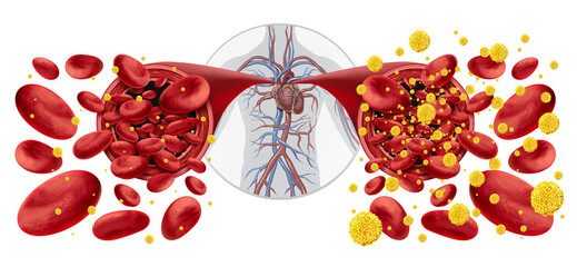 Diabetes Symptoms And Diabetic Blood Glucose as a symbol for Hypoglycemia and Hyperglycemia or Normal glucose levels as a symbol for low or high blood sugar resulting in insulin imbalance.