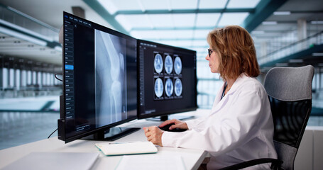 Older Radiologist Analyzing Neuro Images On Computer, Collaborating