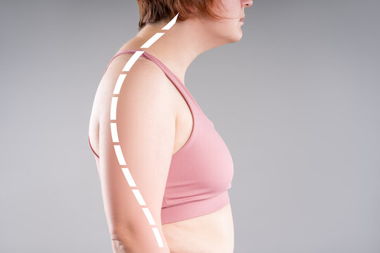 Text neck, stretching exercise for posture, neck pain, cervical spine hernia, woman with curvature of spine on gray background - Powered by Adobe