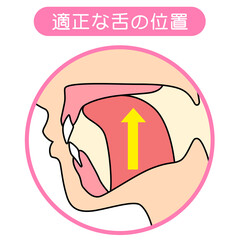 正しいミューイングの方法　適正な舌の位置と誤った舌の位置 © koti