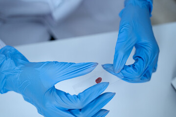 Laboratory research with blood sample in tube being dripped for medical test using liquid medicine...