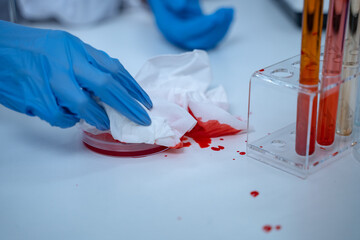 Laboratory research with blood sample in tube being dripped for medical test using liquid medicine...