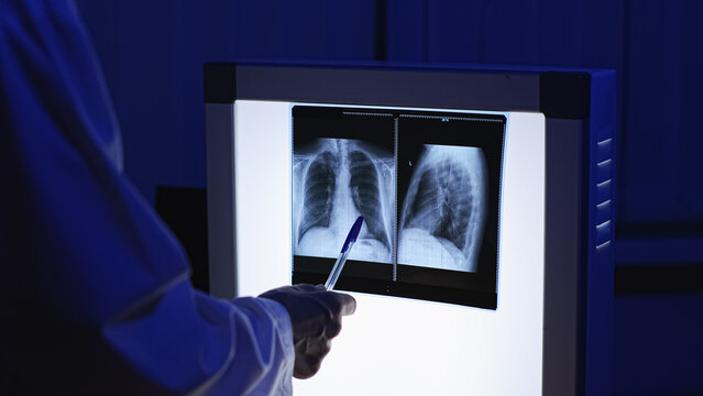 X-ray. Close-up X-ray. X-ray of a man's lungs. High-quality photo.