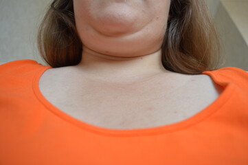 close-up view of a woman's lower face, chin, and neck area wearing an orange shirt, photographed...
