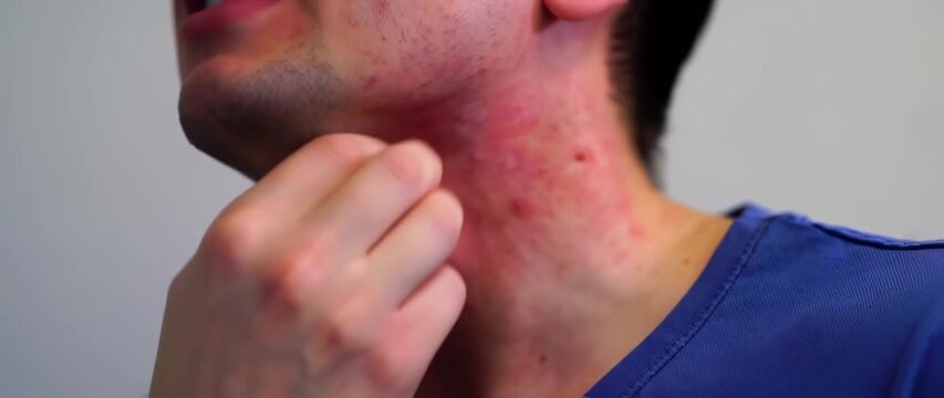 Inflamed skin on neck