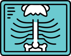 Medical X Ray Imaging of Human Rib Cage