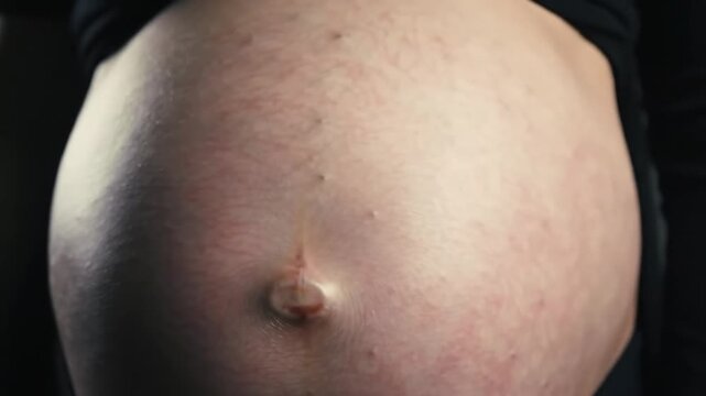 Pregnant belly exposed showing linea nigra
