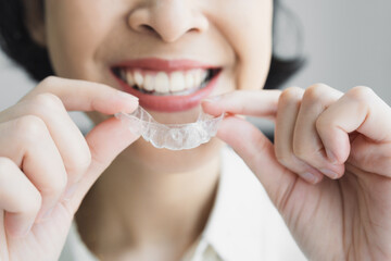 A close-up of a woman placing transparent dental aligners on her teeth, showcasing oral health and...