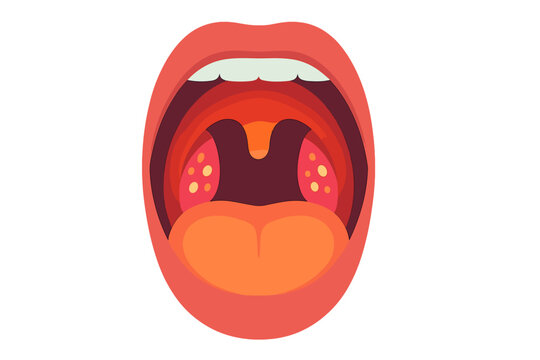 Open human mouth with visible tongue and tonsils illustration inflamed throat close-up