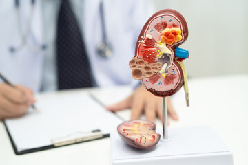 Chronic kidney disease ckd, Doctor hold human model to treat and study in hospital.