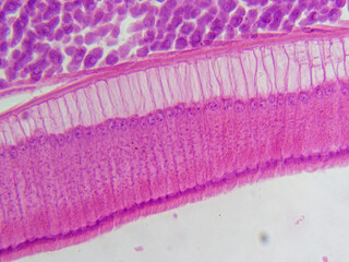 Histology Microscope Image of Male Ascaris Roundworm Intestines Cross Section (400x)