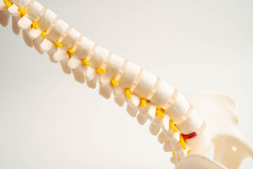 Spinal nerve and bone, Lumbar spine displaced herniated disc fragment, Model for treatment medical...