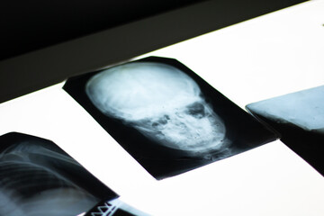 X-ray images of human skull and anatomy