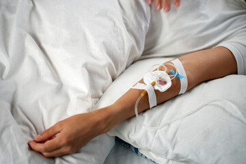 Close-up of an Intravenous IV Drip on a Patient's Arm