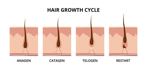 Hair growth cycle showing anagen, catagen, telogen and restart phases