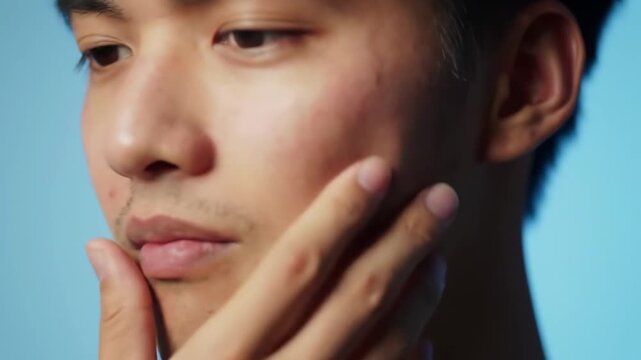 Mumps Facial Swelling On One Side Of Jaw And Cheek On Light Blue Background For Medical Education