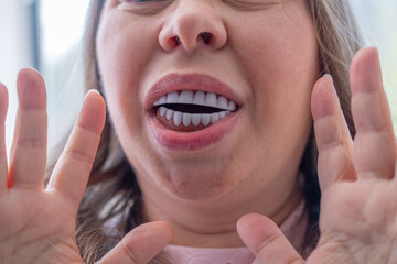 Dental retainers, Positive aging photography showcasing mature woman's genuine happiness and...