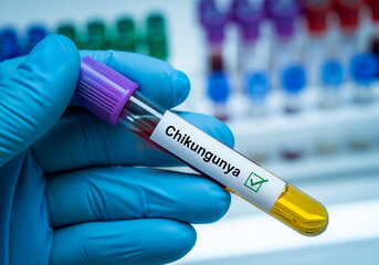 Positive chikungunya test blood sample held in gloved hand