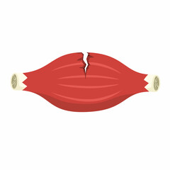 Vector illustration of torn muscle, injured muscle or ruptured muscle on white background
