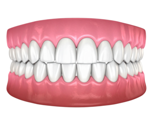 Realistic Dental Arch with Straight Teeth, No Braces, Transparent Background PNG