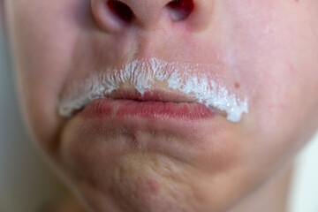 Child with a milk mustache and making an angry or sad face with his lips indicating that he is not happy because he does not like milk