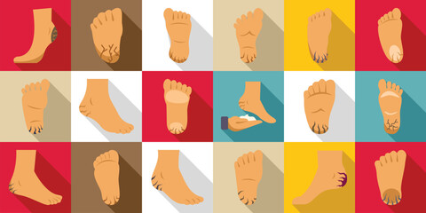 Cracked heels icons set. Foot conditions icons set showing dry cracked heels and applying moisturizing cream