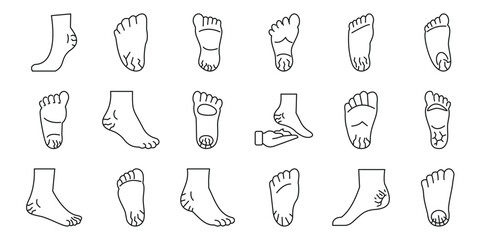 Cracked heels icons set. Set of black line icons representing feet in various positions, showcasing soles and heels for medical or anatomical studies