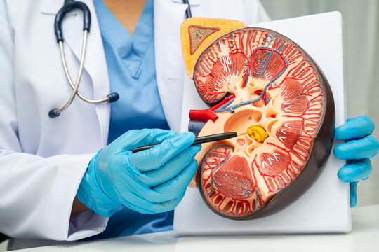 Chronic kidney disease, doctor with model for treatment urinary system, urology, Estimated glomerular filtration rate eGFR.