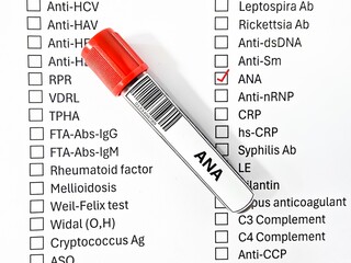 Blood sample tube and paper order request for anti-nuclear antibody test analysis.