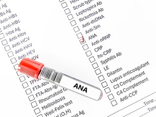 Blood sample tube and paper order request for anti-nuclear antibody test analysis.