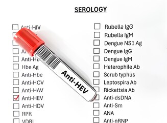 Blood sample tube and paper order request for anti-HEV test analysis.