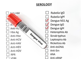 Blood sample tube and paper order request for dengue virus test analysis.
