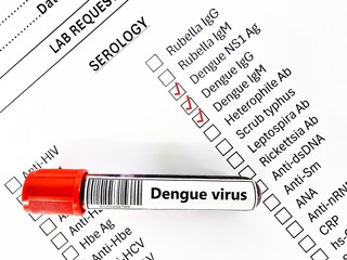 Blood sample tube and paper order request for dengue virus test analysis.