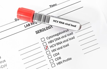 Blood sample tube and paper order request for HCV RNA viral load test analysis.